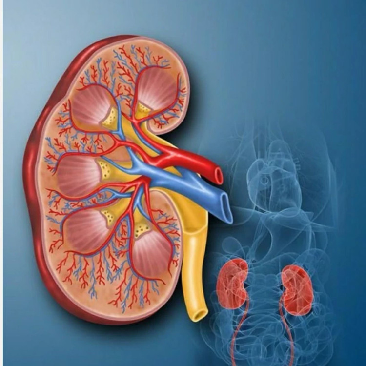پکیج رفع سنگ کلیه گیاهی رویال