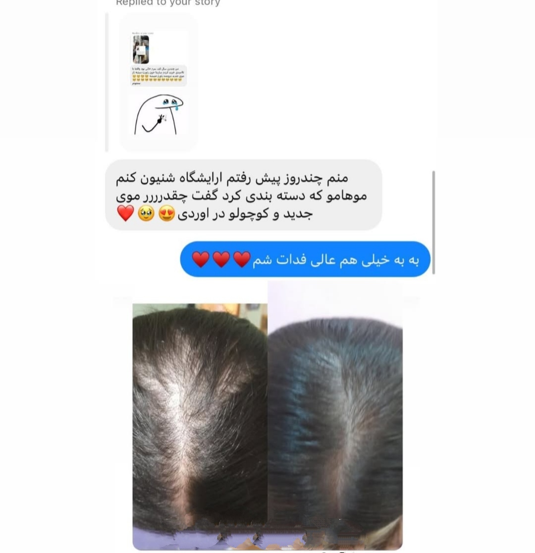 پک کامل رویش مجدد و تقویت مو | کنترل ریزش، تحریک رشد و افزایش ضخامت مو