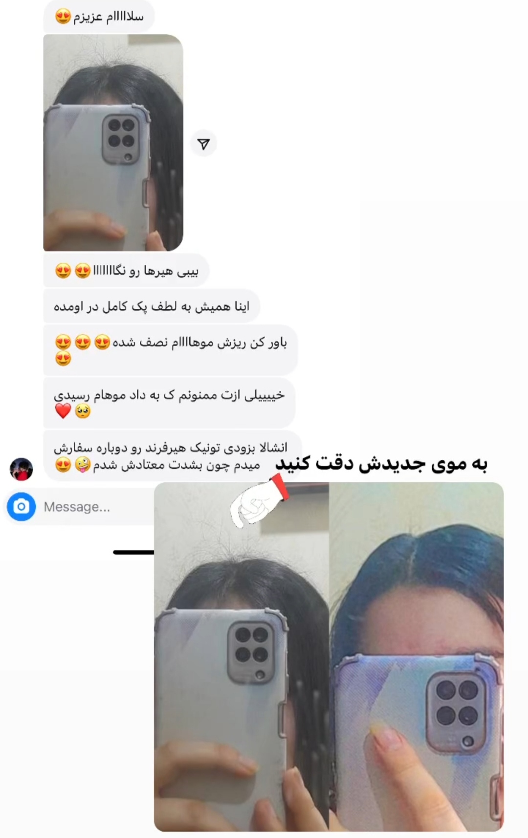 پک کامل رویش مجدد و تقویت مو | کنترل ریزش، تحریک رشد و افزایش ضخامت مو