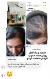 پک کامل رویش مجدد و تقویت مو | کنترل ریزش، تحریک رشد و افزایش ضخامت مو