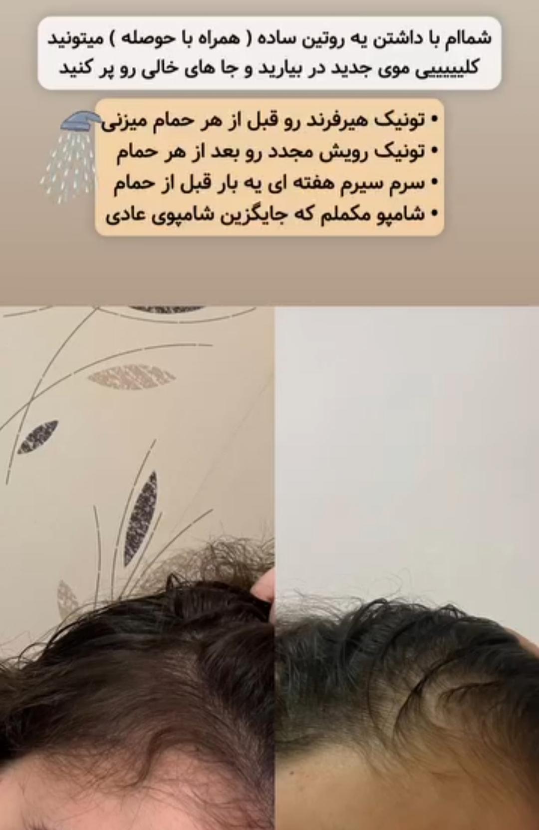 پک کامل رویش مجدد و تقویت مو | کنترل ریزش، تحریک رشد و افزایش ضخامت مو