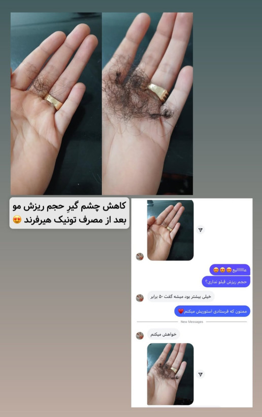 پک تخصصی رفع چربی کف سر | شامپو مورینگا + تونیک تقویت مو هیرفرند
