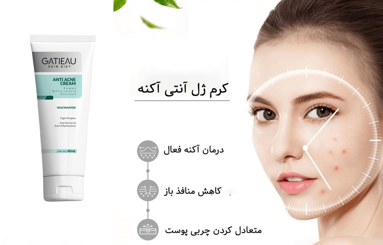 کرم ژل آنتی آکنه ۴۰ میل گاتیو (ضد جوش و ضد لک)