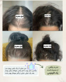 پک اقتصادی تونیک تقویت کننده و رشد مو هیرفرند و رویش مجدد اصل