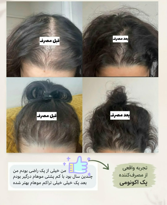 پک اقتصادی تونیک تقویت کننده و رشد مو هیرفرند و رویش مجدد اصل