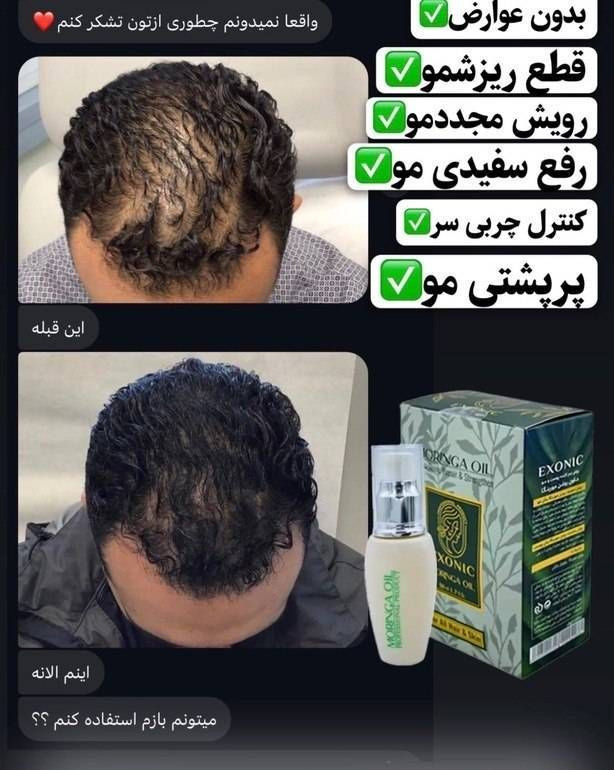 پک ترمیم و تقویت مو حاوی عصاره روغن مورینگا سرم دوفاز و شامپو اصل اکسونیک