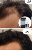 پک اقتصادی تونیک تقویت کننده و رشد مو هیرفرند و رویش مجدد اصل